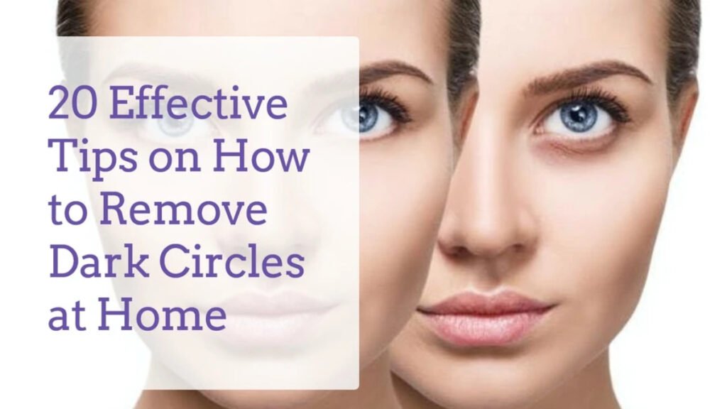 Effective Tips On How To Remove Dark Circles At Home