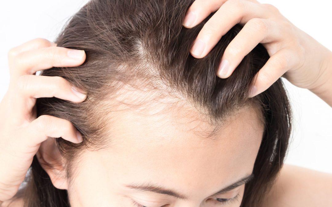 Grow Baby Hair on Forehead : Skin Care Top News
