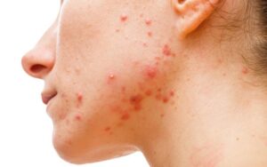 HOW TO CHOOSE THE RIGHT FACIAL CLEANSER?