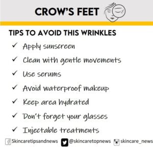 wrinkles
