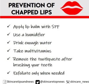 chapped lips