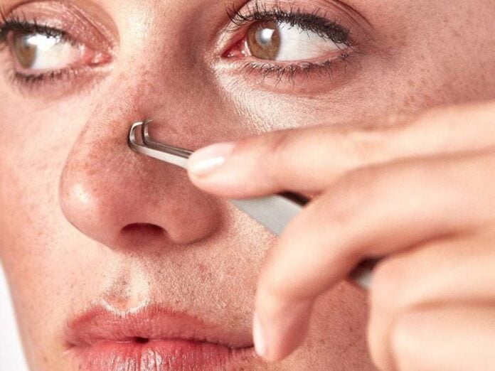 HOW TO REMOVE BLACKHEADS USING HOME REMEDIES AND TREATMENTS