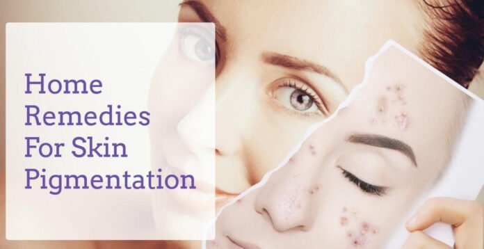 Skin Pigmentation And Dark Spots: Home Remedies To Manage Them Naturally