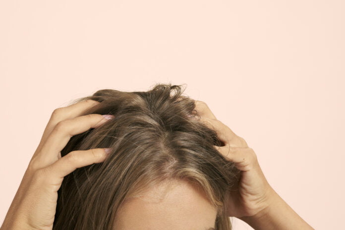 Does Sweating Lead To Hair Loss?