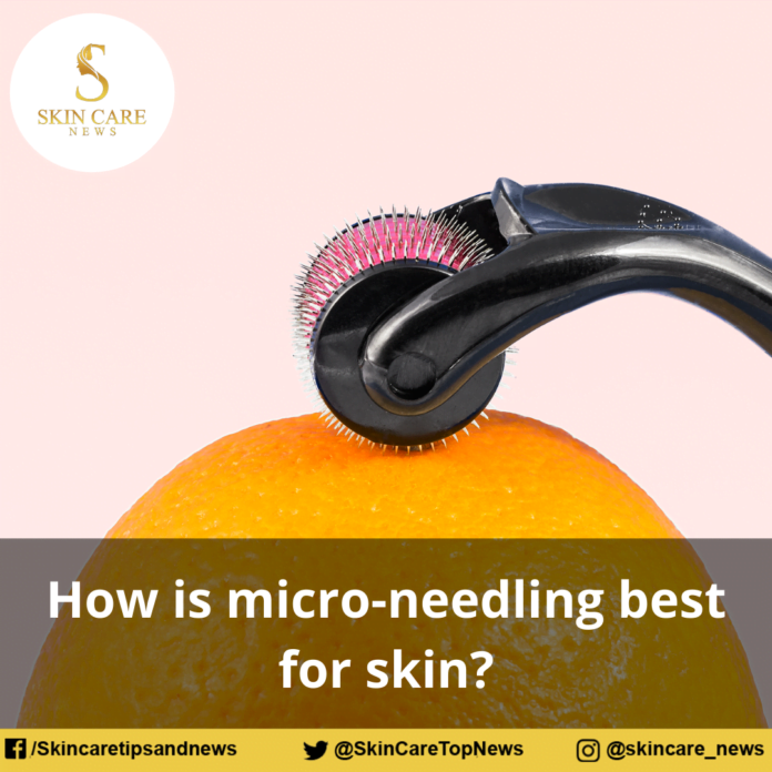 How is micro-needling best for skin?