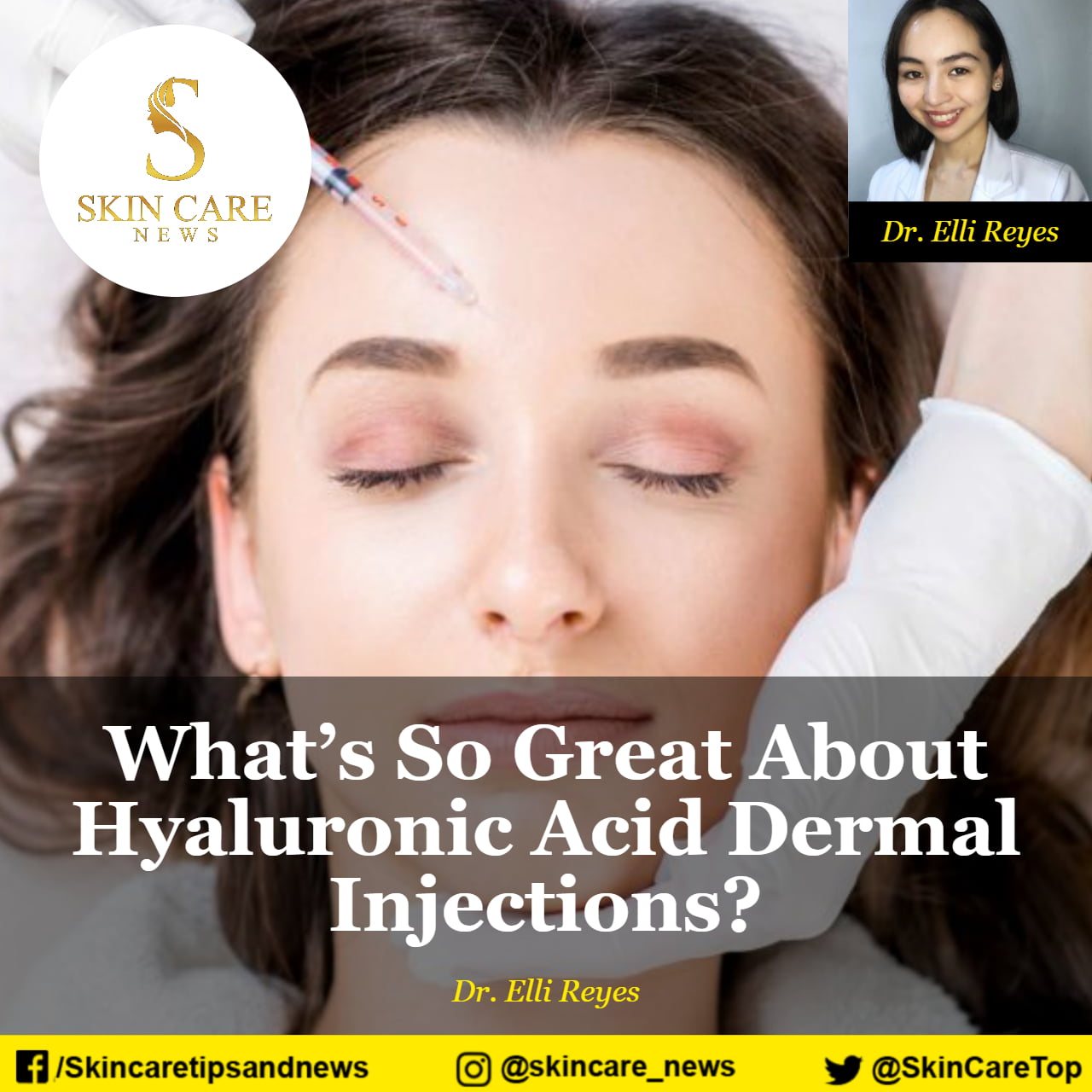 What’s So Great About Hyaluronic Acid Dermal Injections?
