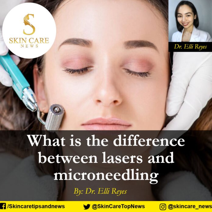 What is the difference between lasers and microneedling