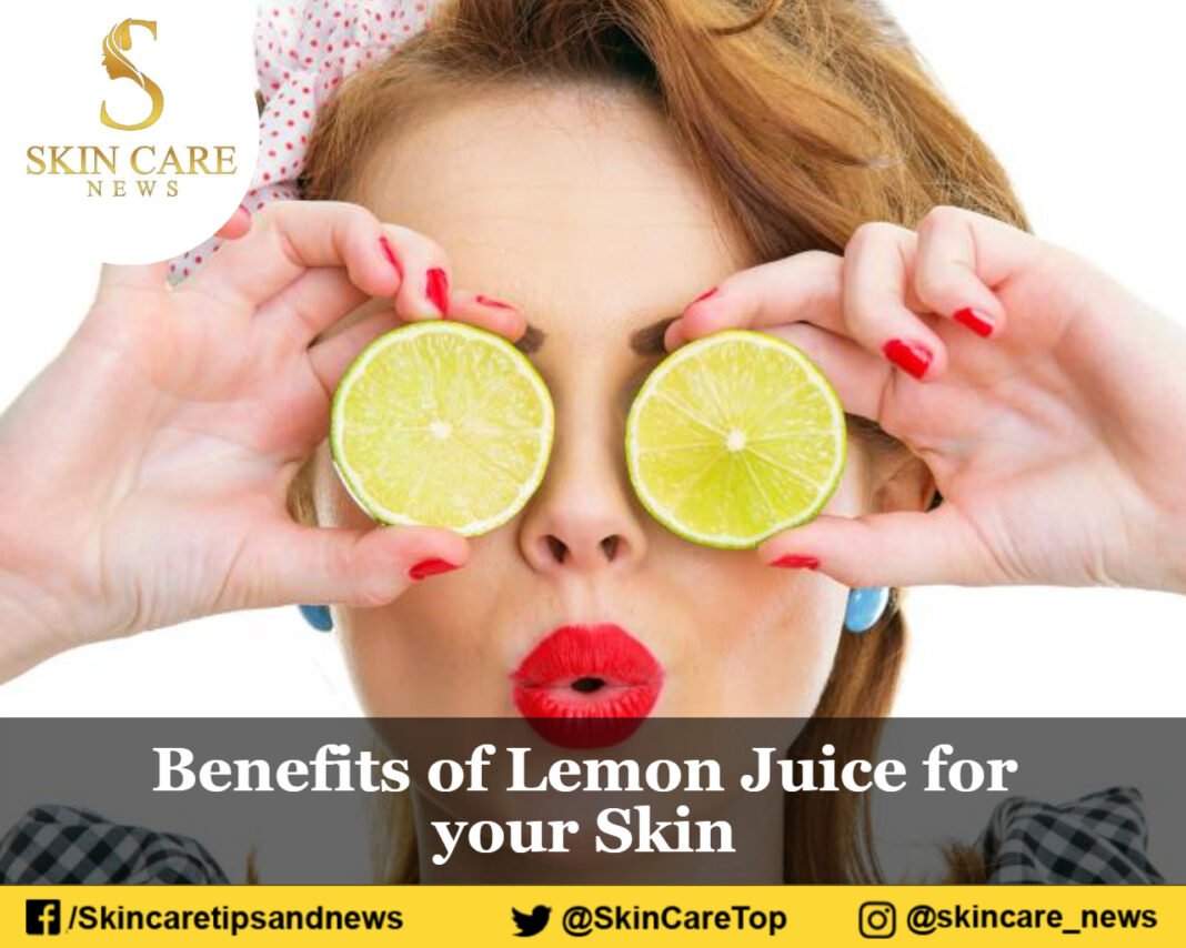 BENEFITS OF LEMON JUICE FOR YOUR SKIN