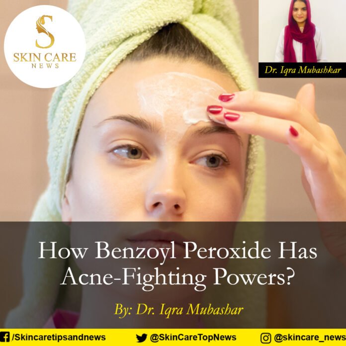 How Benzoyl Peroxide Has Acne-Fighting Powers?