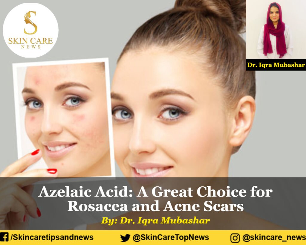 Azelaic Acid A Great Choice for Rosacea and Acne Scars