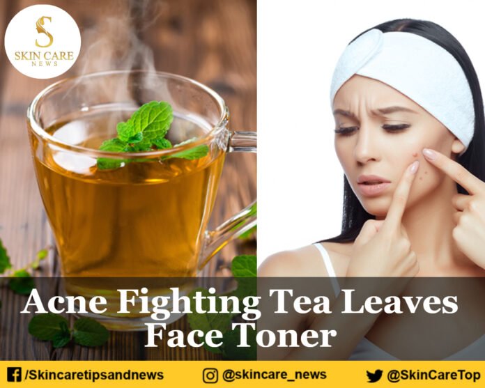 Acne Fighting Tea Leaves Face Toner