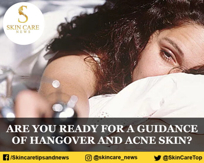 ARE YOU READY FOR A GUIDANCE OF HANGOVER AND ACNE SKIN?
