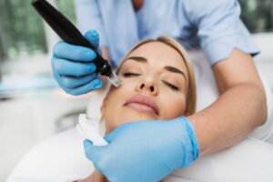 Plasma pen treatment, What is it, and how it works?