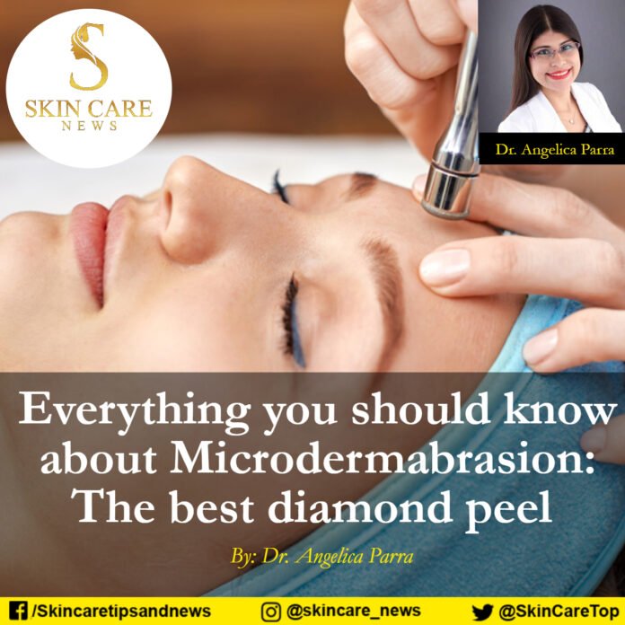 Everything you should know about Microdermabrasion: The best diamond peel.