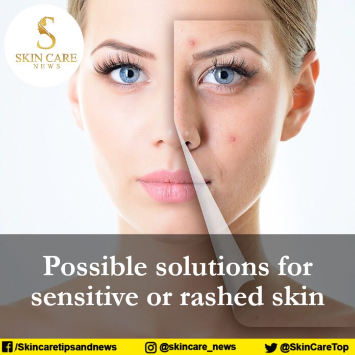 Possible solutions for sensitive or rashed skin