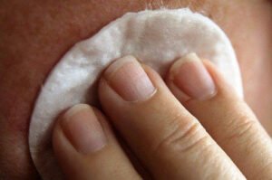 Avoid these DIY hacks to protect your skin