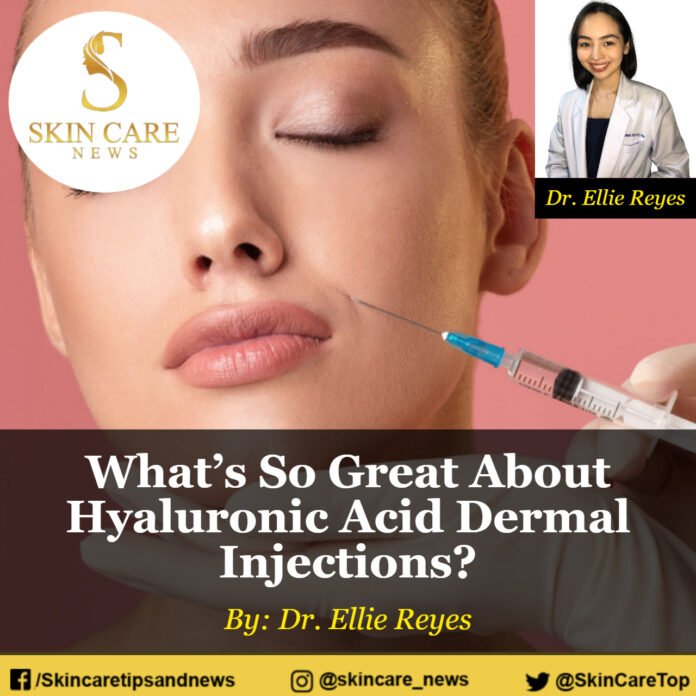 What’s So Great About Hyaluronic Acid Dermal Injections?