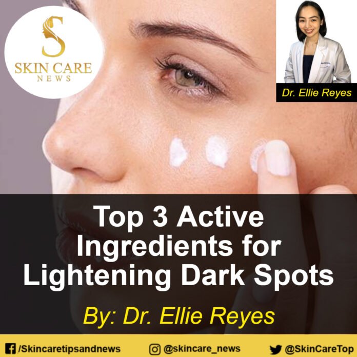 Top 3 Active Ingredients for Lightening Dark Spots