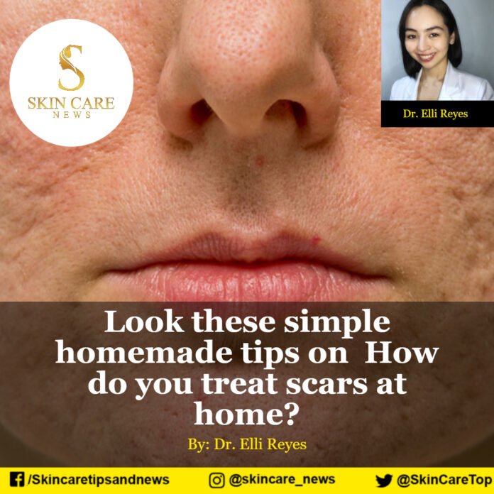 Look these simple homemade tips on How do you treat scars at home?