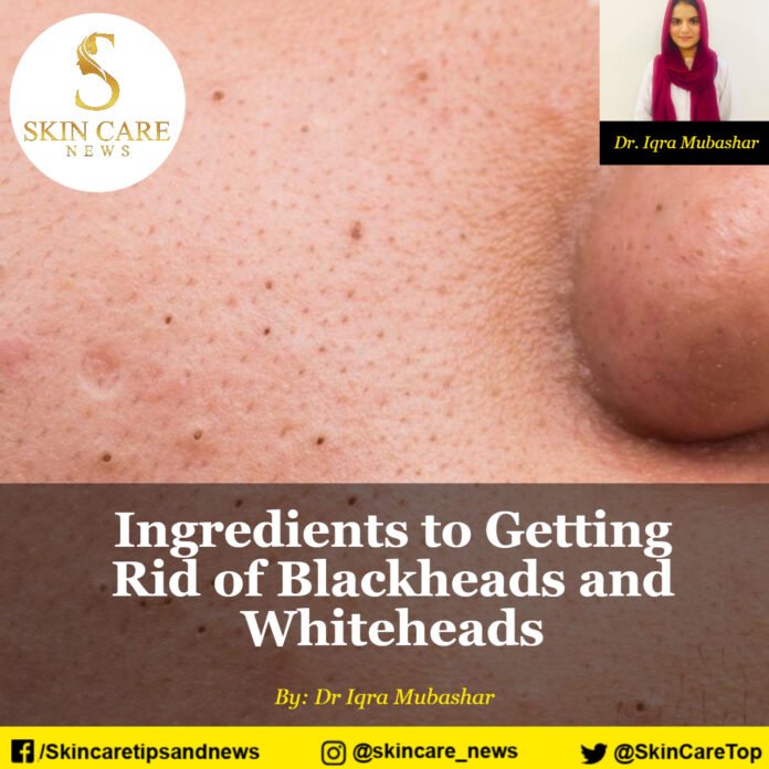 Ingredients to Getting Rid of Blackheads and Whiteheads