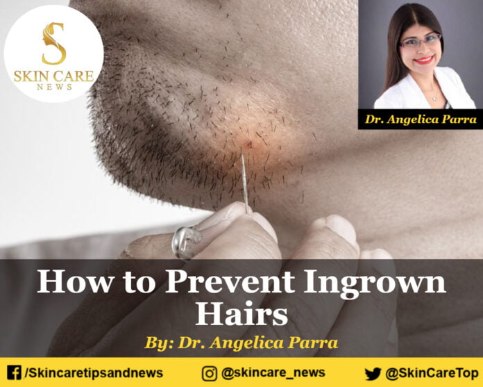 How to prevent ingrown hairs