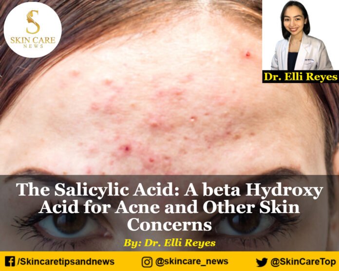 The Salicylic Acid: A beta Hydroxy Acid for Acne and Other Skin Concerns