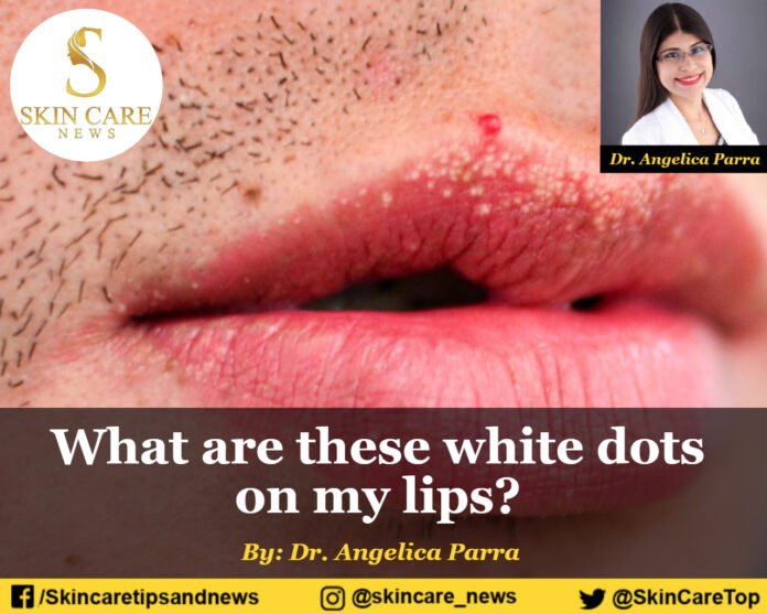 What are these white dots on my lips?