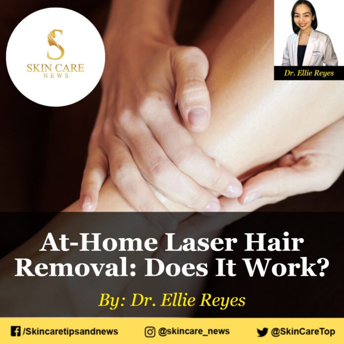 At-Home Laser Hair Removal: Does It Work?