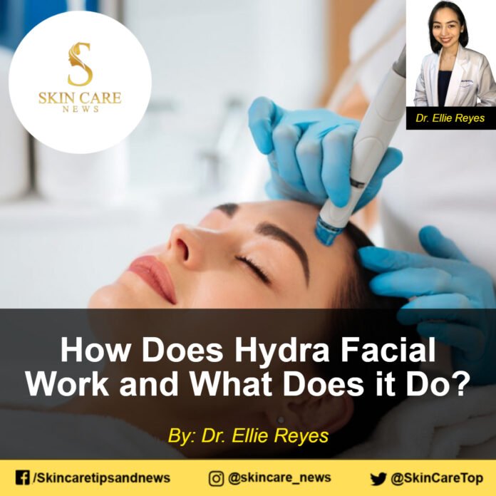 How Does Hydra Facial Work and What Does it Do?
