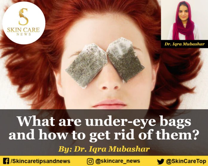 What are under eye bags and how to get rid of them?