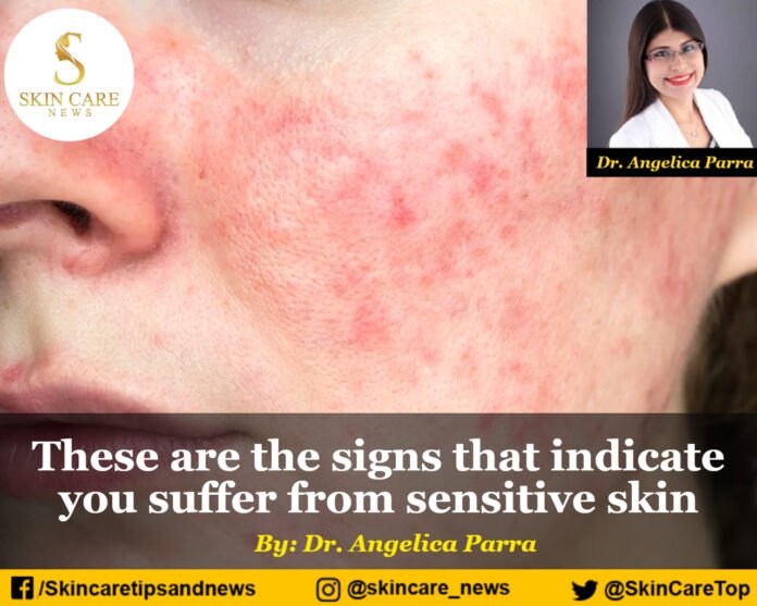 These are the signs that indicate you suffer from sensitive skin