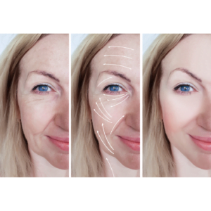 Are You in Your Late 20s to Early 30s and Want to Tighten Loose Skin?