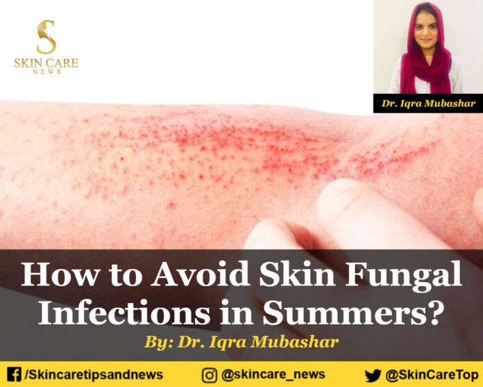 How to Avoid Skin Fungal Infections in Summers?
