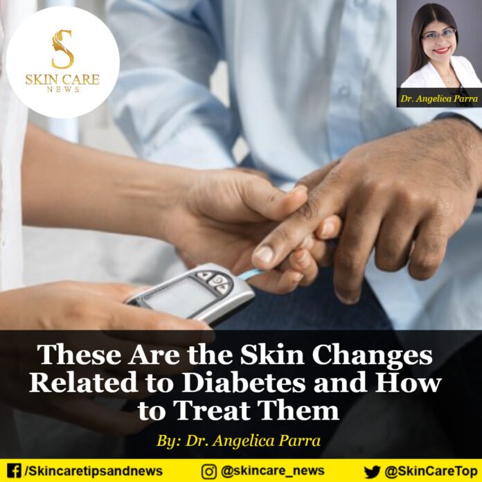 These Are the Skin Changes Related to Diabetes and How to Treat Them