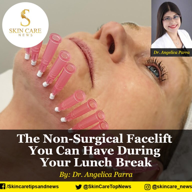 The NonSurgical Facelift You Can Have During Your Lunch Break
