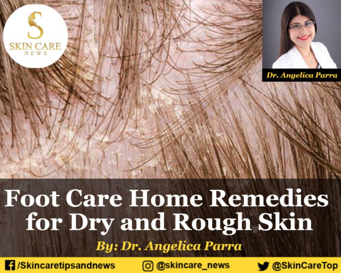 All You Need to Know about Dandruff: Prevention and Treatment