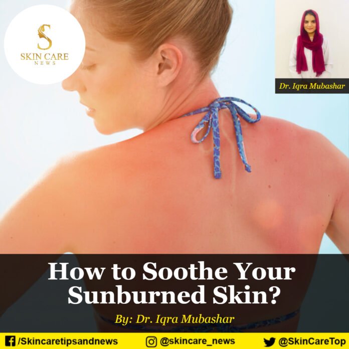How to Soothe Your Sunburned Skin?