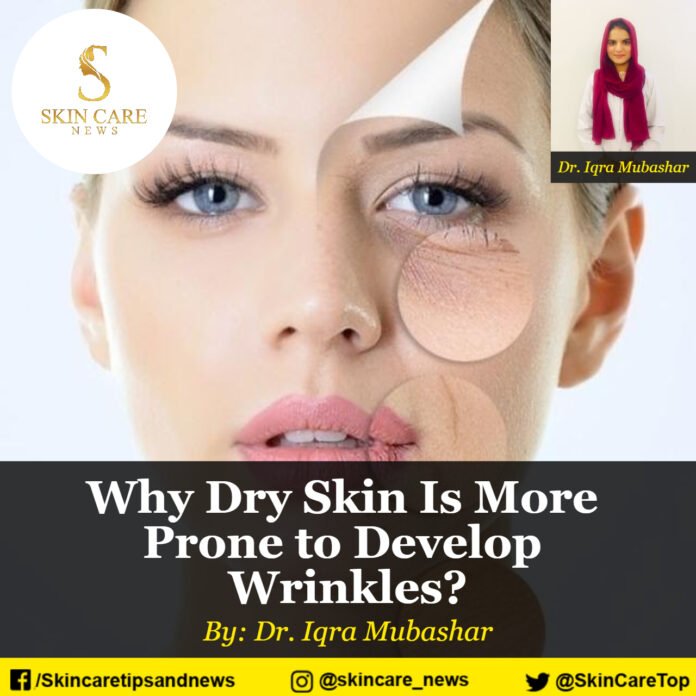 Why Dry Skin Is More Prone to Develop Wrinkles?