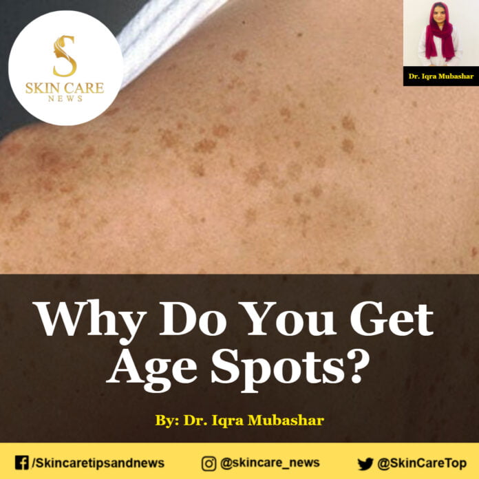 Why Do You Get Age Spots?