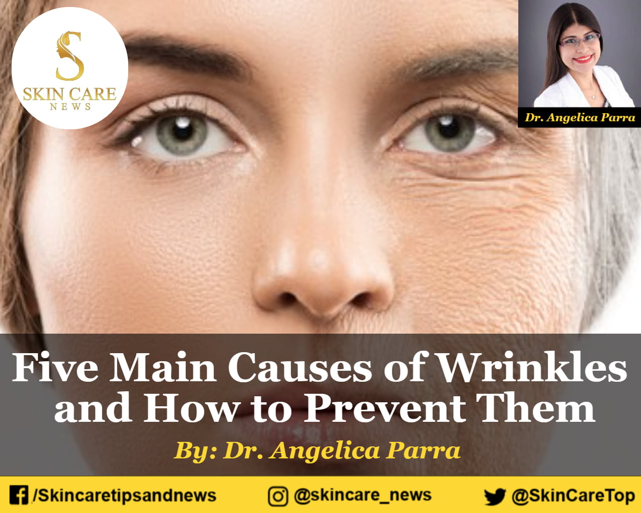 Five Main Causes of Wrinkles and How to Prevent Them