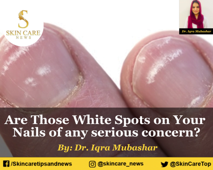 Are Those White Spots on Your Nails of any serious concern?