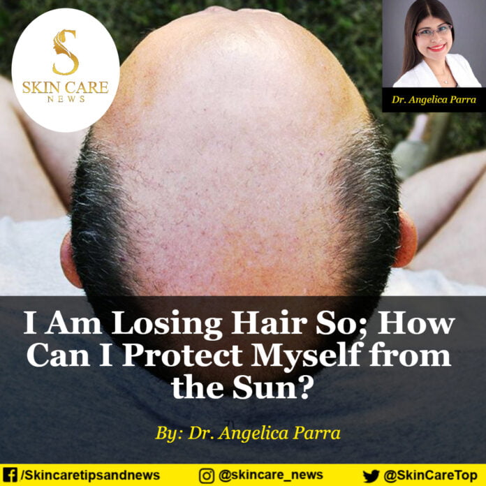 I Am Losing Hair So How Can I Protect Myself from the Sun?