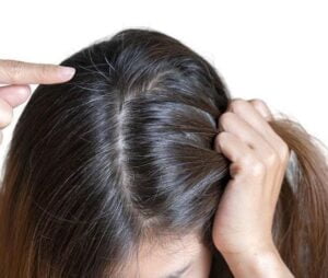 Why Your Hair Turn Grey at a Young Age?