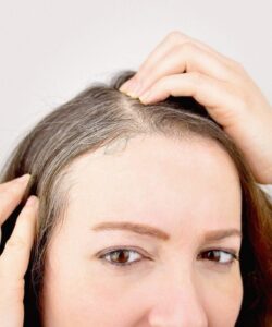 Why Your Hair Turn Grey at a Young Age?