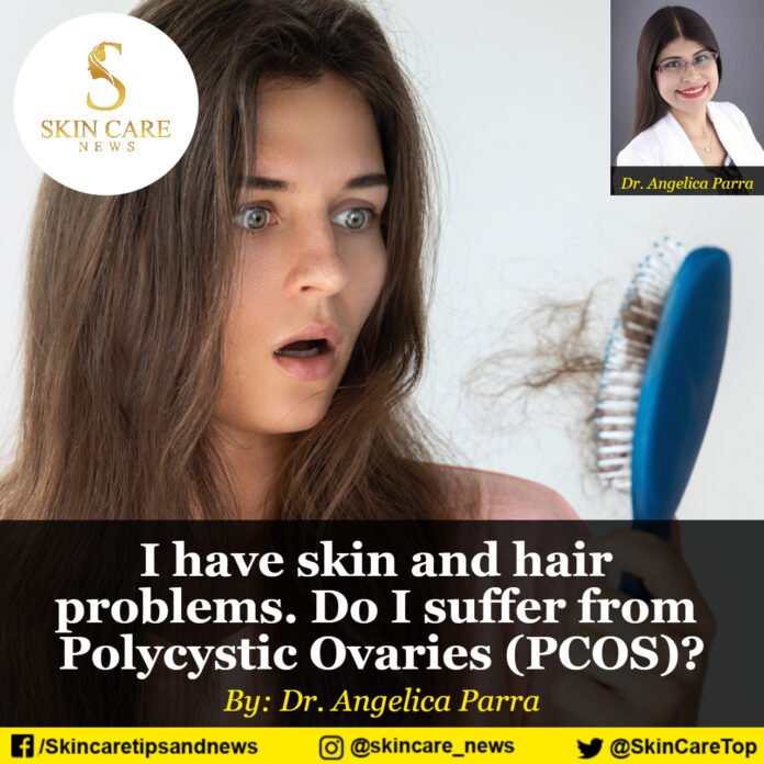 I have skin and hair problems. Do I suffer from Polycystic Ovaries (PCOS)?