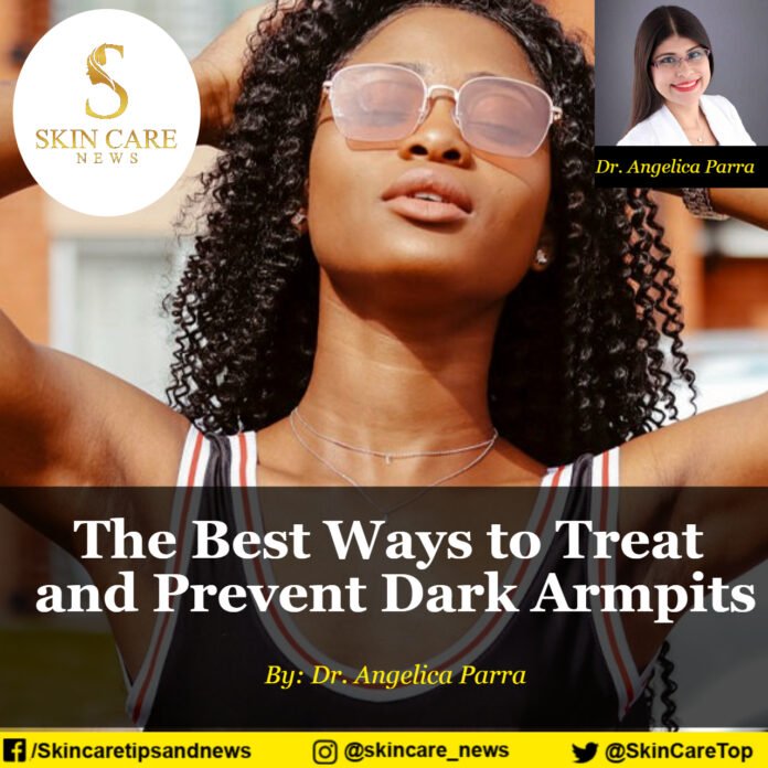 The Best Ways to Treat and Prevent Dark Armpits