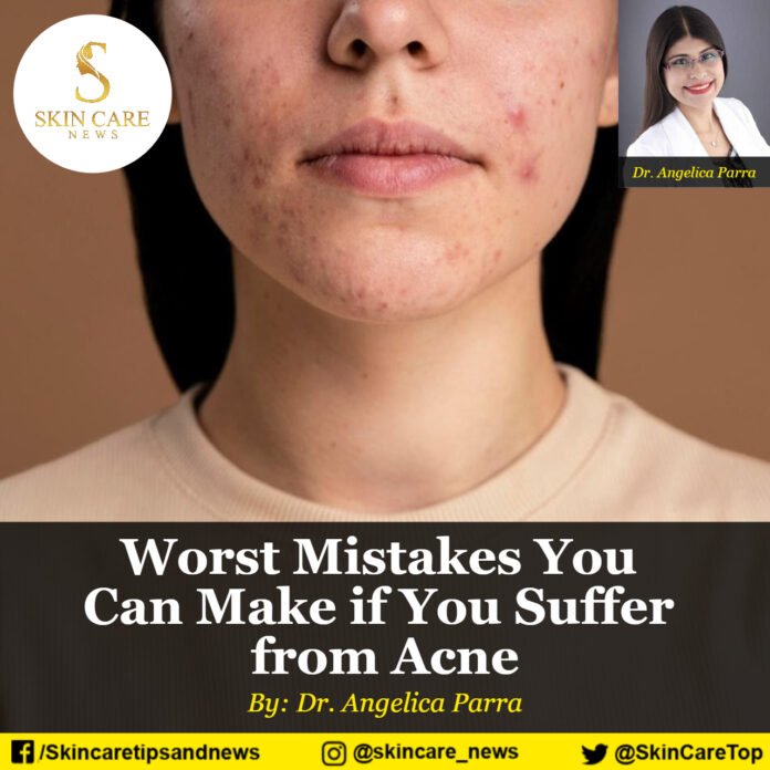 Worst Mistakes You can Make if You Suffer from Acne
