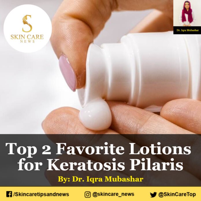 Top 2 Favorite Lotions for Keratosis Pilaris
