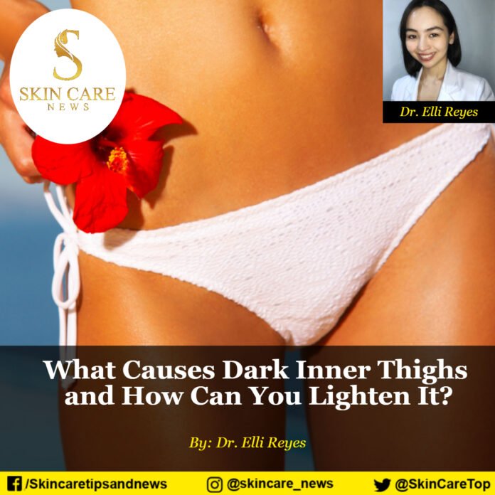What Causes Dark Inner Thighs and How Can You Lighten It?