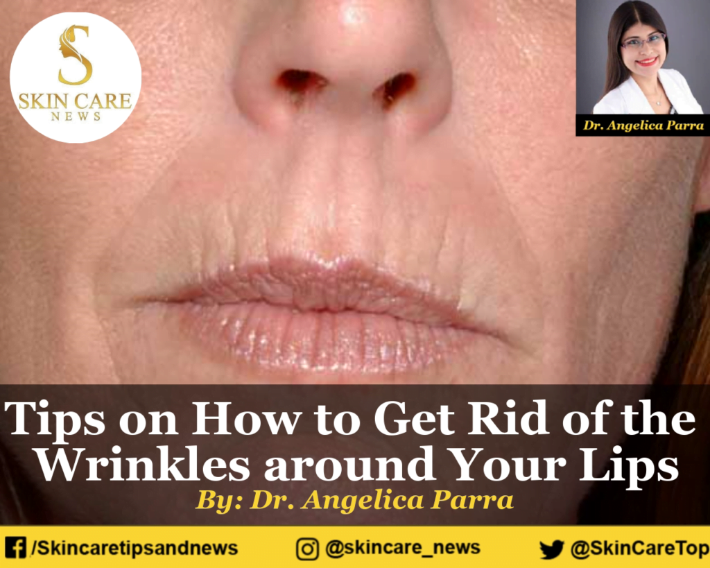 Tips on How to Get Rid of the Wrinkles around Your Lips